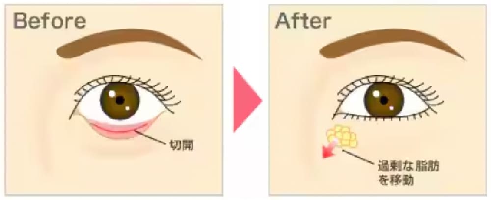 裏ハムラ