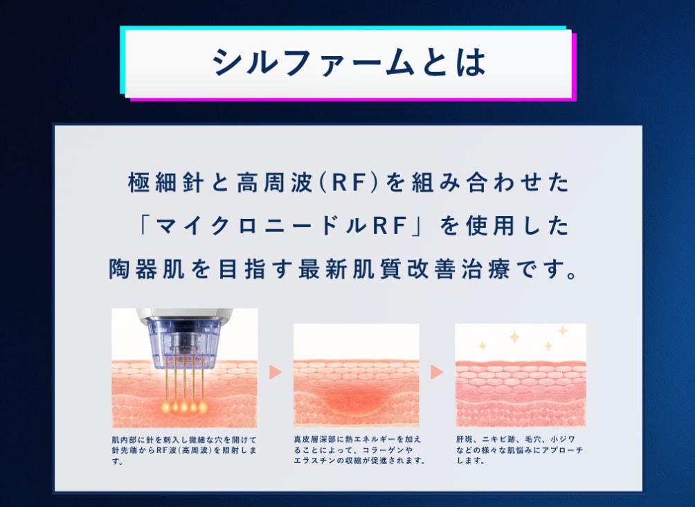 シルファームの仕組み