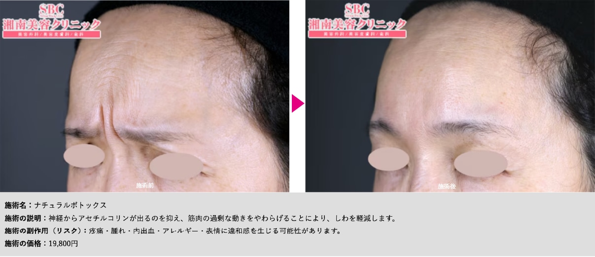 ついしわを寄せてしまう癖がある方にもおすすめ！