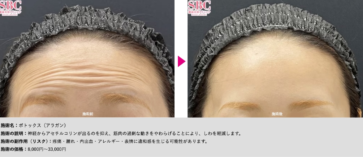 刻まれてしまう前早めの対策しませんか？