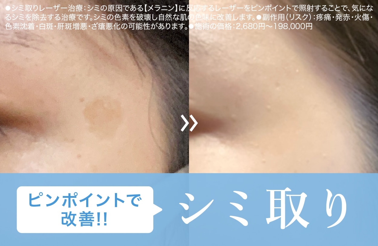 紫外線が弱まった今がチャンス♡