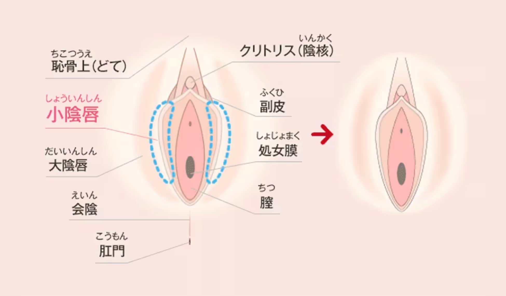 裏垢　処女膜 