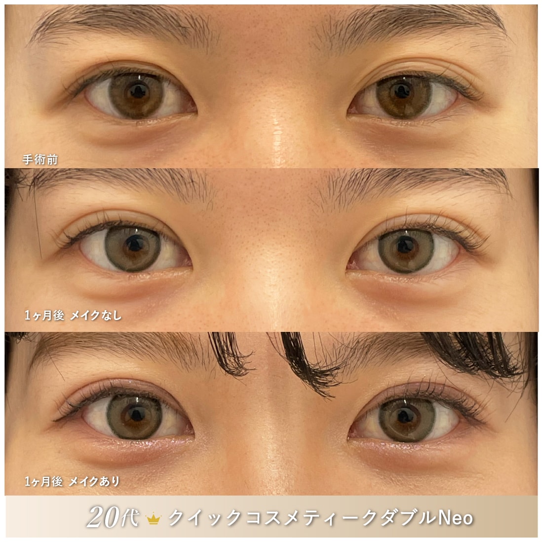 あなたはどの目元が好きですか？