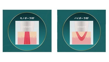 デンシティアイ