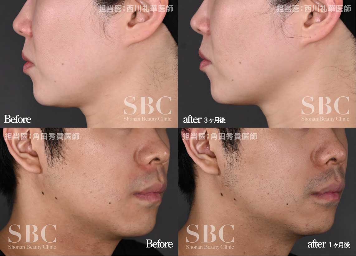 実際どれくらい効果がある？