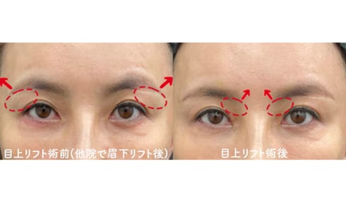 おすすめな理由<br />
