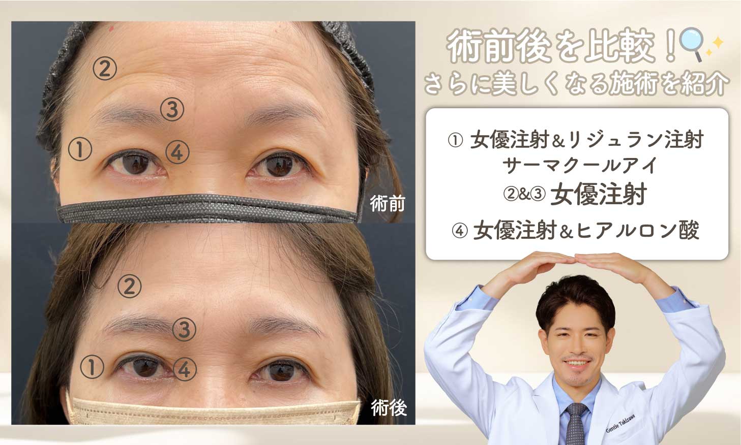 術後の症例をジェントルが解説！