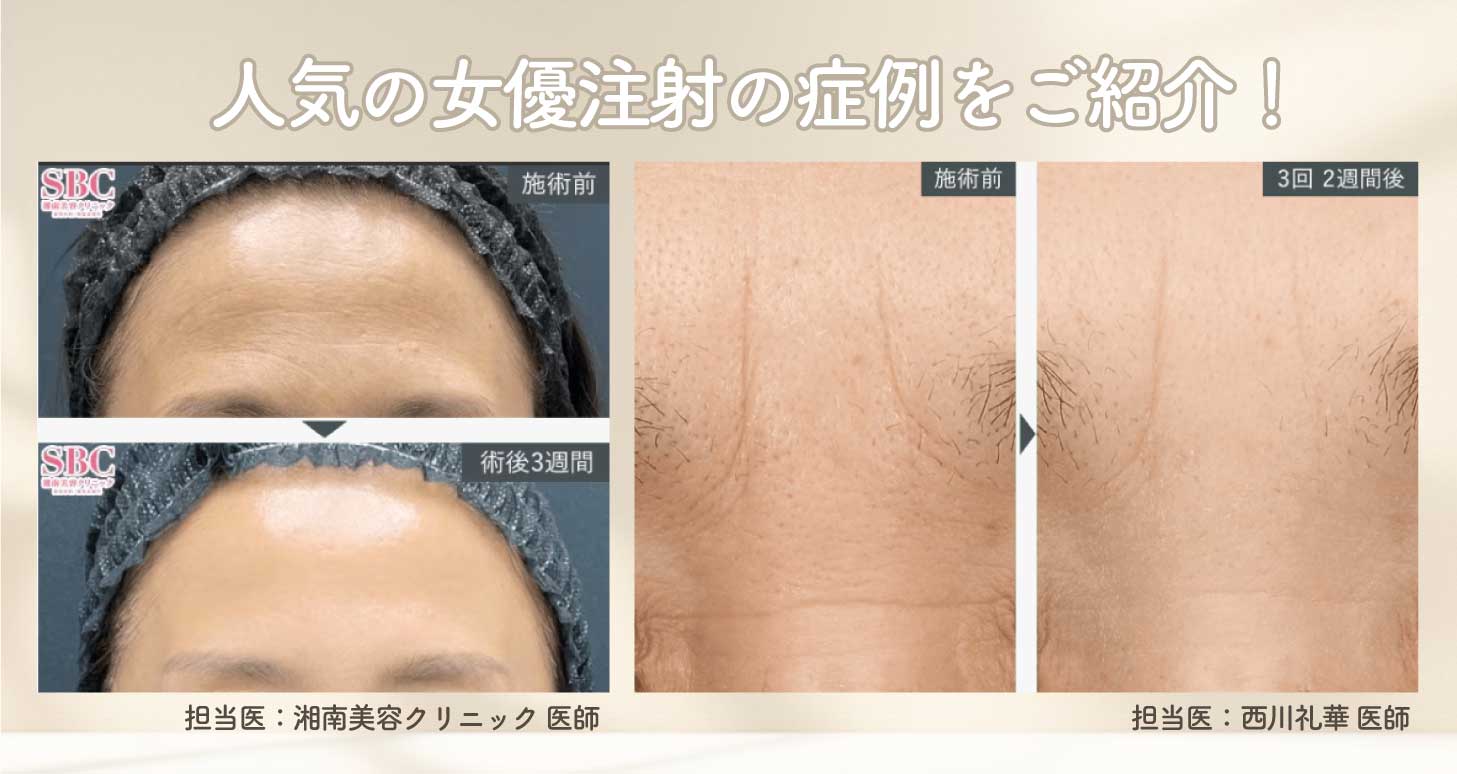 外科手術だけじゃない！目元の若返り！