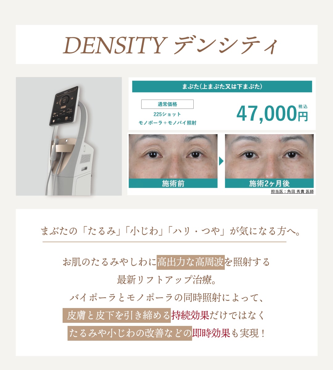 ② デンシティ（上まぶた）