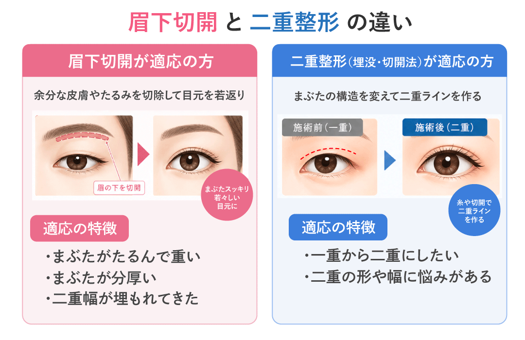 眉下切開と二重整形の違い