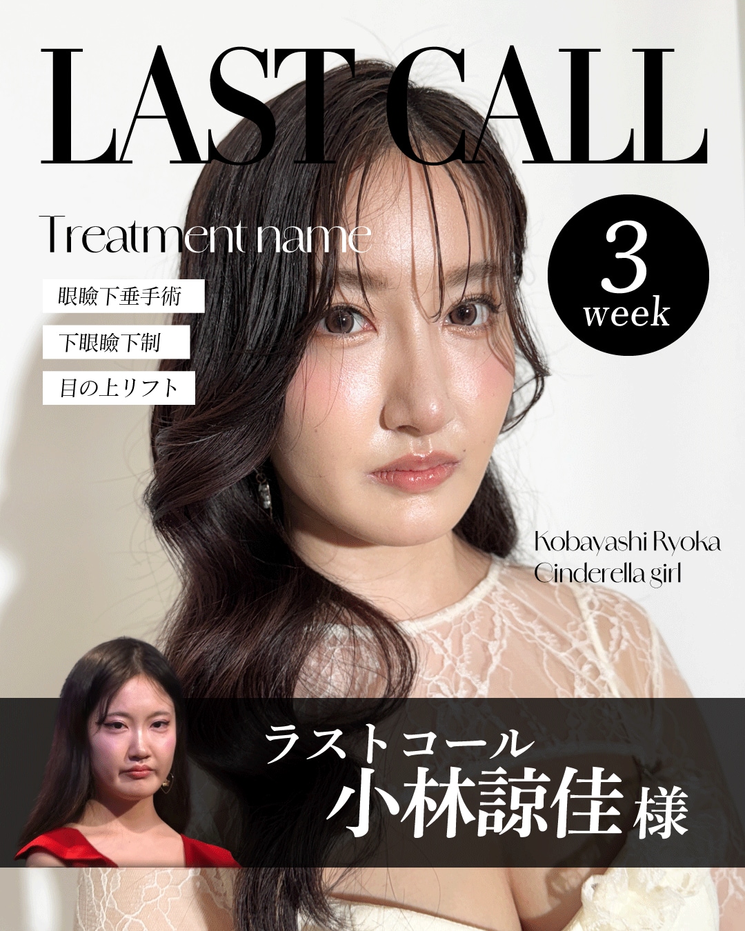 表参道Oculus院_小林諒佳さん執刀
