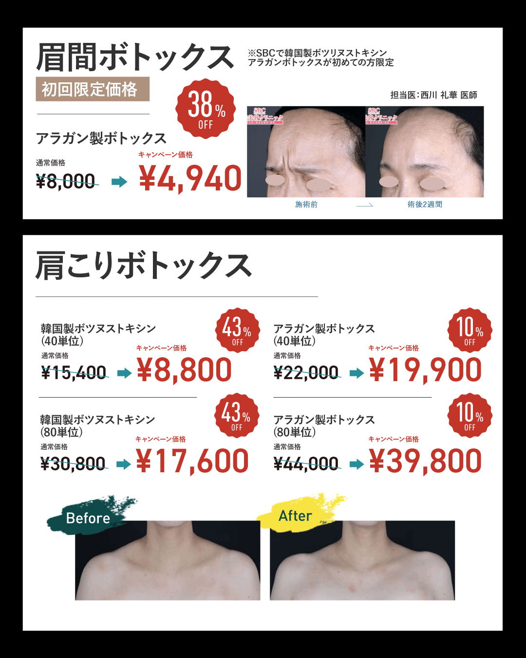 表参道Oculus院_ボトックスキャンペーン価格