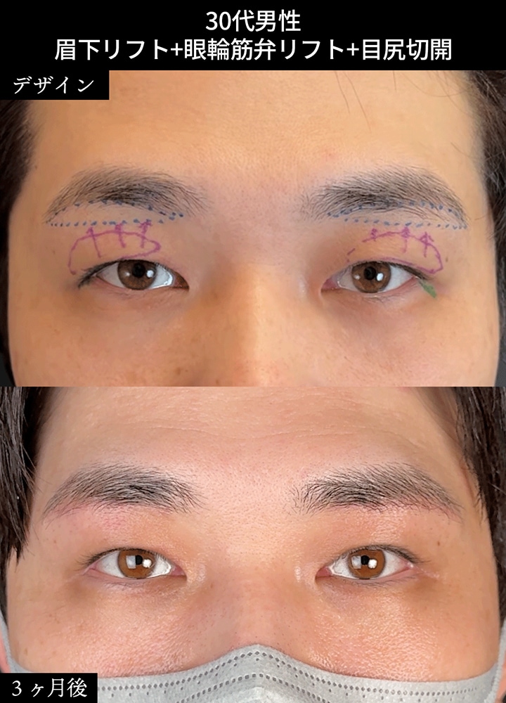 ①周りにバレずに、自然に変えられるか