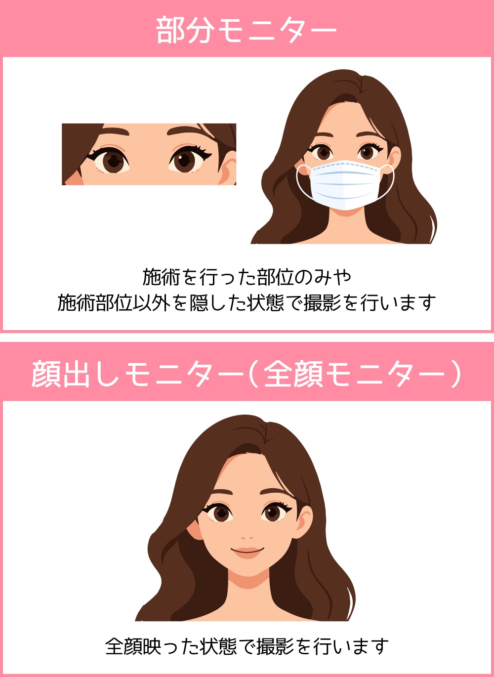部分モニターと全顔モニターの違いは？