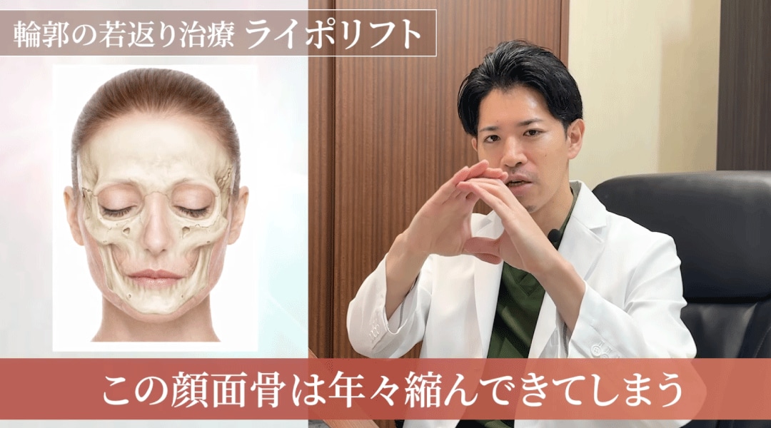 顔のたるみの根本原因は「骨のコケ」