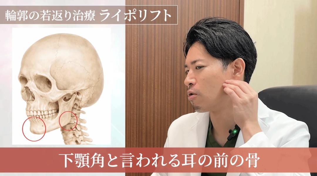 たるみの真犯人は「顔面骨の萎縮」