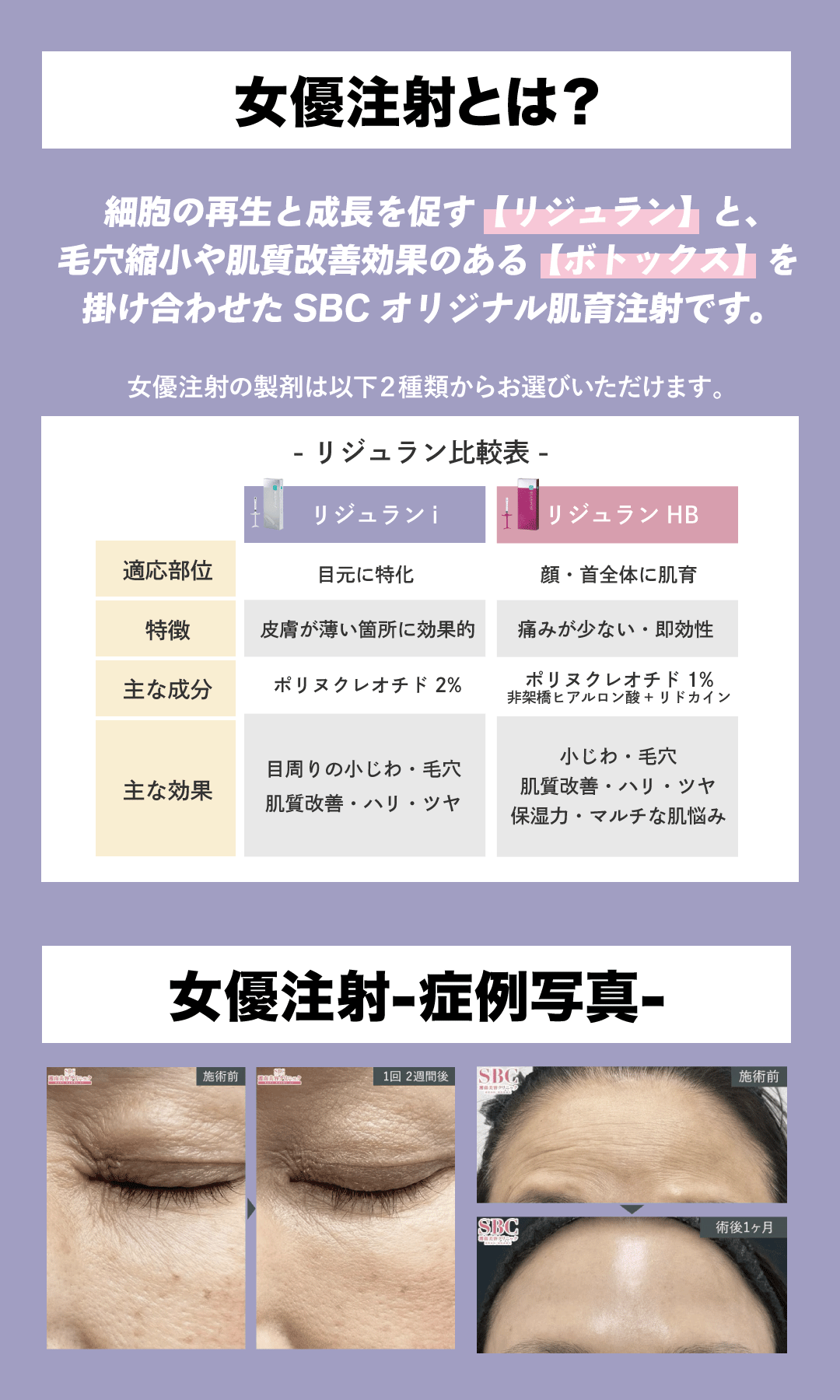 表参道Oculus院_女優とは?症例