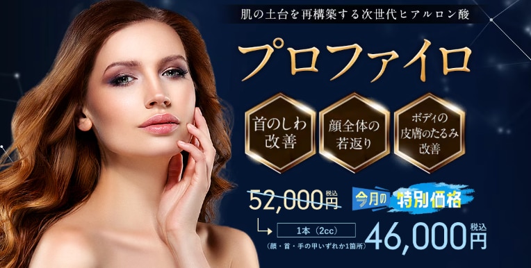 プロファイロ