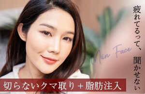 目の下の切らないたるみ取り+脂肪注入法				
