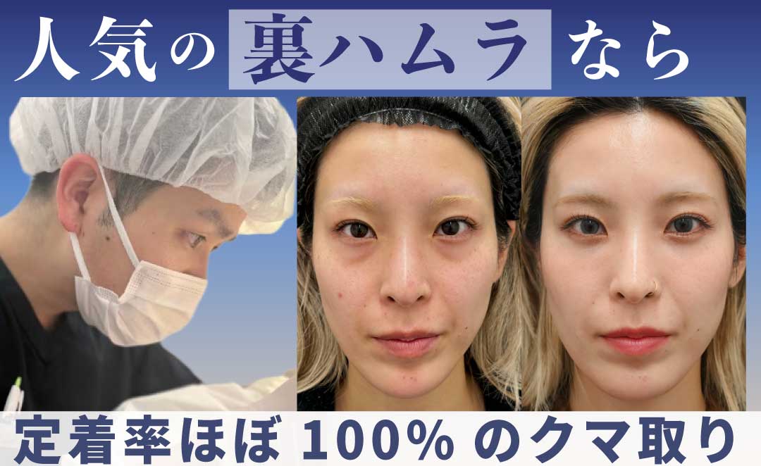 裏ハムラ