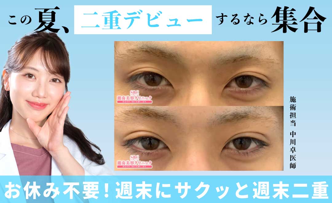 週末二重術/Teen二重術