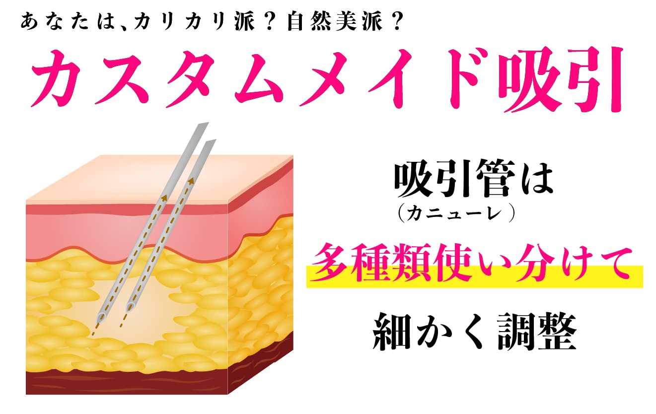 あなたは「カリカリ派？」「自然美派？」カスタムメイド吸引
