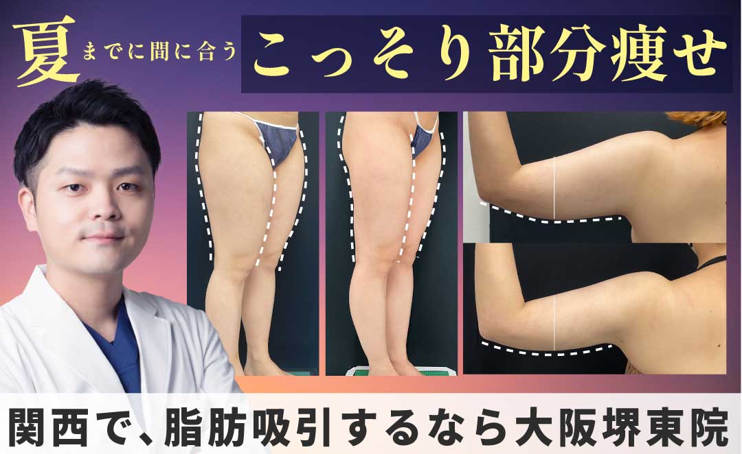 ムコ式脂肪吸引