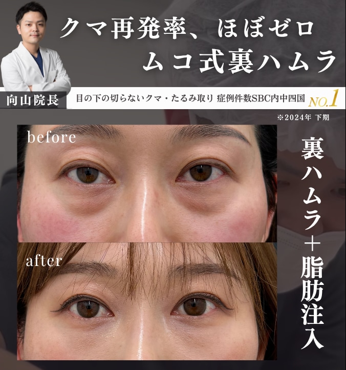【老け顔卒業🌟】裏ハムラ