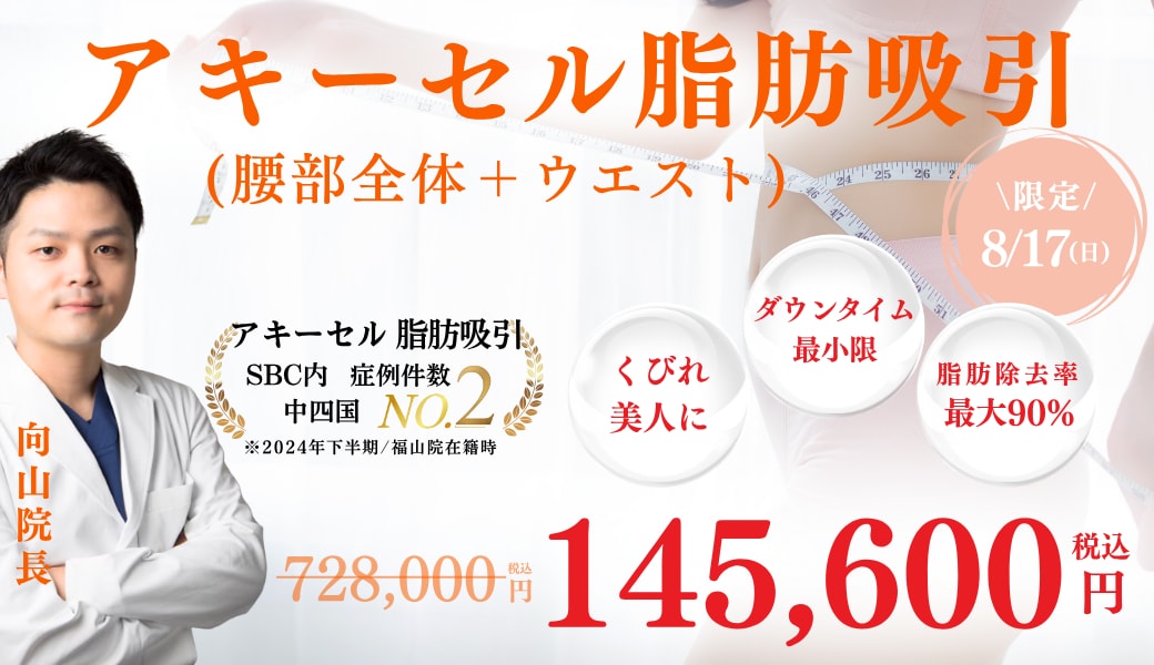 【8/17日限定】「腰部全体＋ウエスト」憧れのくびれ美人に✨