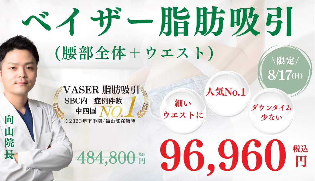 【8/17日限定】「腰部全体＋ウエスト」脂肪吸引でくびれをGET♪<br />
