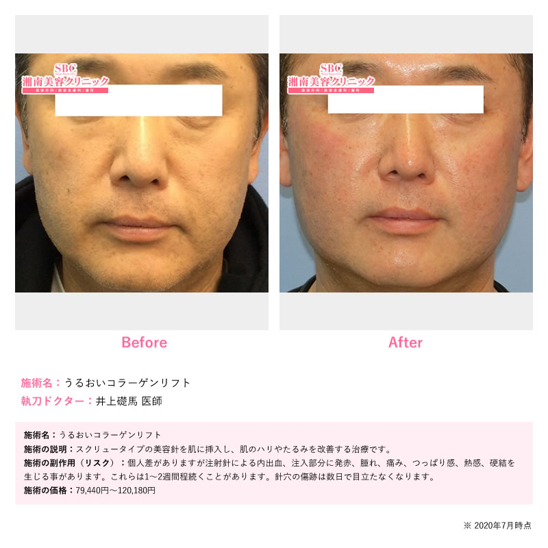 施術時間たった30分‼️