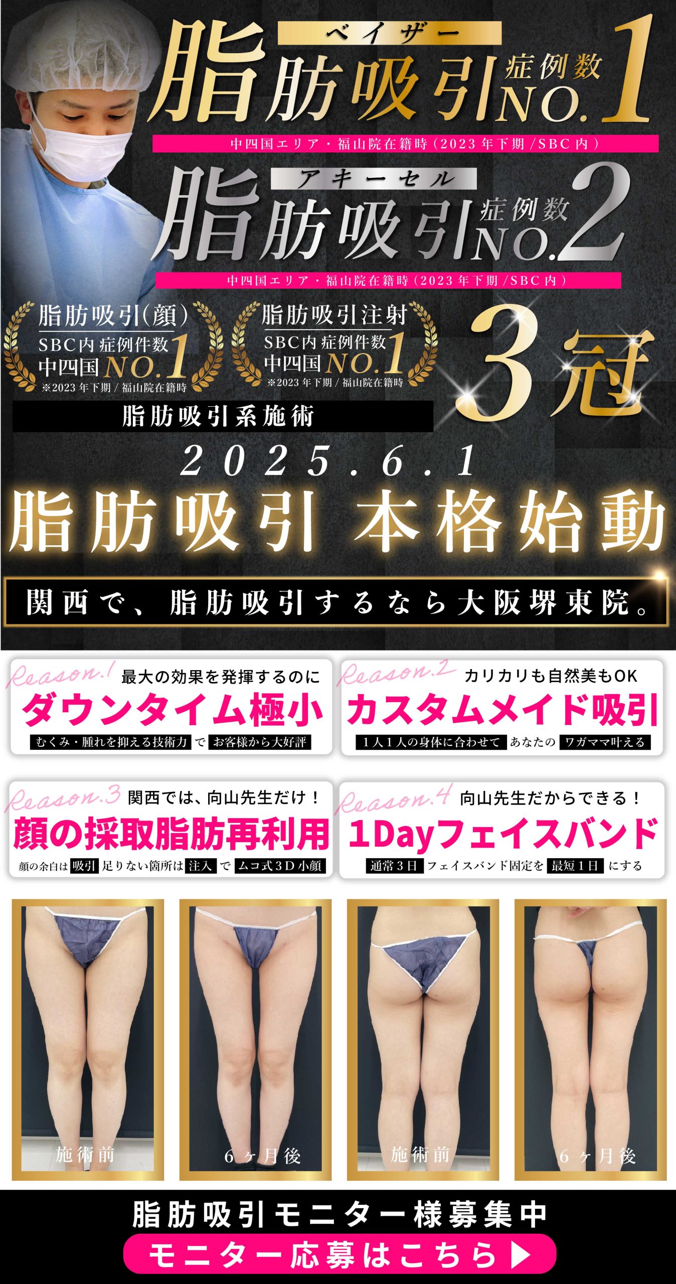 向山院長 脂肪吸引モニターページを確認する