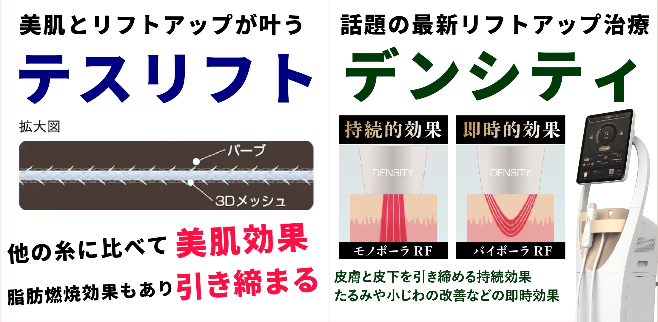 今回の「たるみ撃退セット」は、即効性のあるリフトアップと持続的な引き締めを両立させる、当院おすすめのコンビネーション治療です。