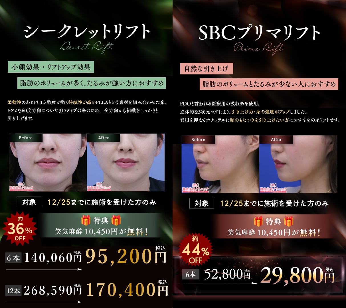 はじめての方にも大人気の「プリマリフト」と、持続力と引き上げ力に定評のある「シークレットリフト」が大幅プライスダウン中です。