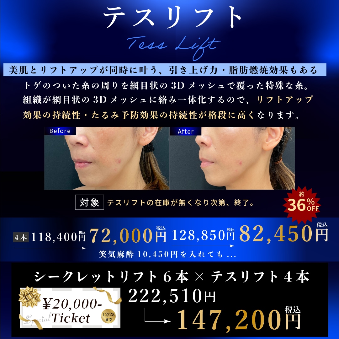 より強力な引き上げと持続力を求める方には、異なる種類の糸を組み合わせるコンビネーション治療がおすすめです。