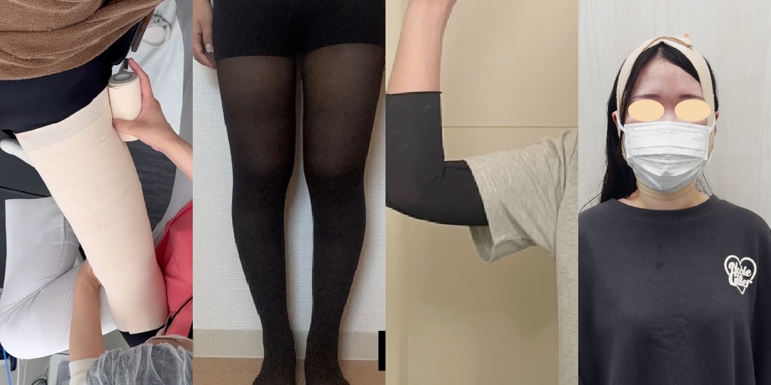 長期休暇【弾丸整形】の<strong>ゴールデンタイム</strong><br />
<strong>大阪の整形でおすすめ</strong>される向山 直樹院長が指導する、年末年始を最大限に活かしたダウンタイム攻略法をご紹介します！