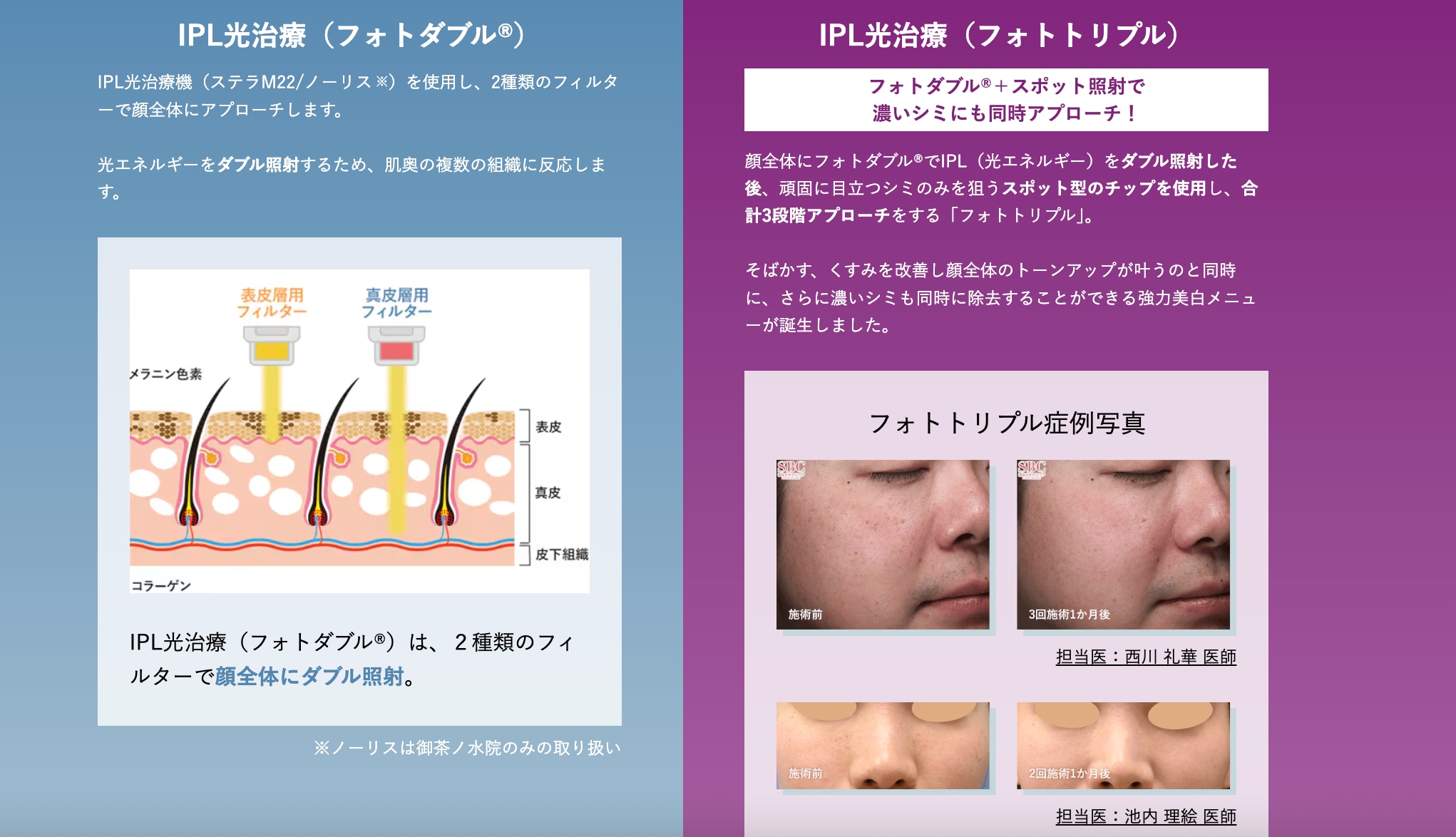 顔全体のシミやそばかす、くすみをまとめてケアしたい方には、光治療の**フォトトリプル**がおすすめです