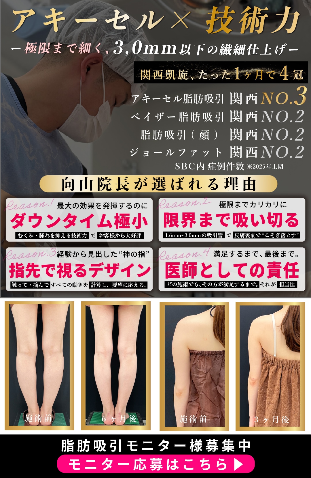 向山院長 脂肪吸引モニターページを確認する