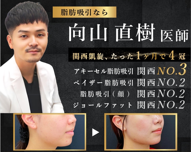 【脂肪吸引は大阪堺東院】向山医師のカスタム吸引が選ばれる理由｜ダウンタイムを抑えて理想のラインへ