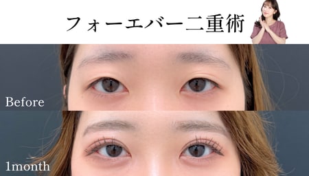 一重にお悩みのお客様