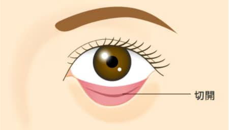 5.皮膚の表面には傷をつけたくない方