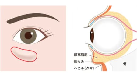 2.くぼみと膨らみがある方