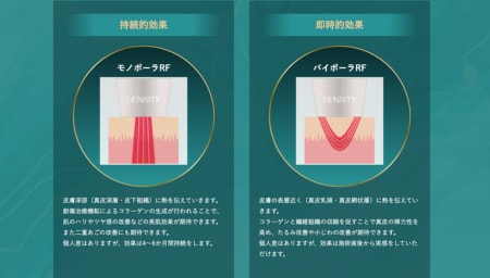 1. 「モノバイ技術」による即効性と持続性のダブルアプローチ