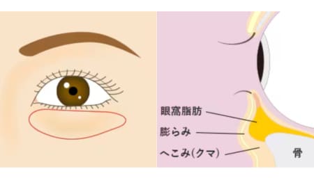 4.皮膚のたるみが少ない方