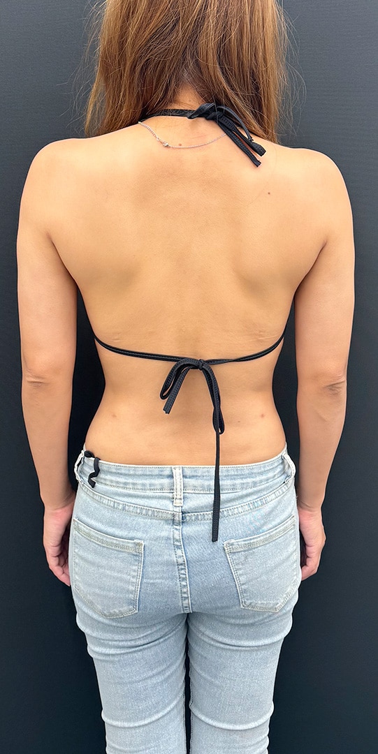 {施術名} {年代}  {性別} の術後の症例写真