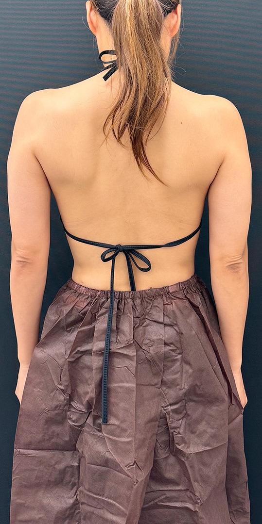 {施術名} {年代}  {性別} の術前の症例写真