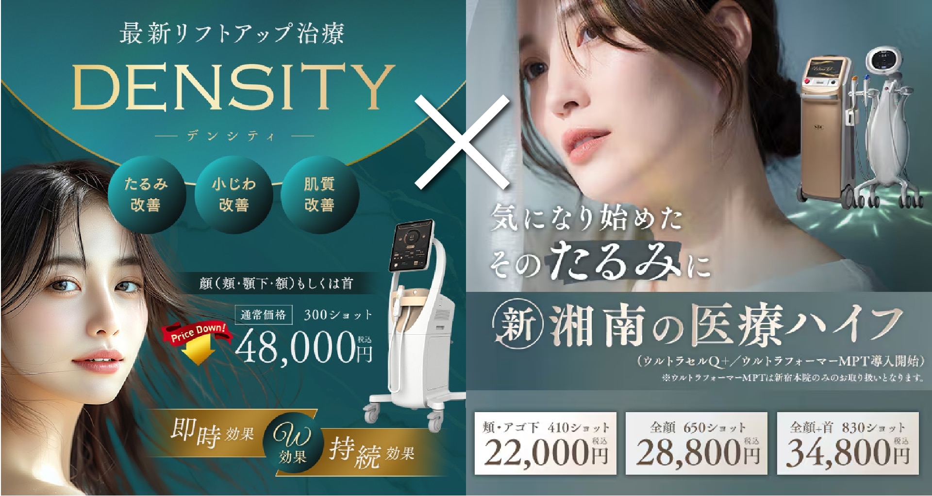 選べる3つのショット数プラン！表示価格からさらに2,000円割引