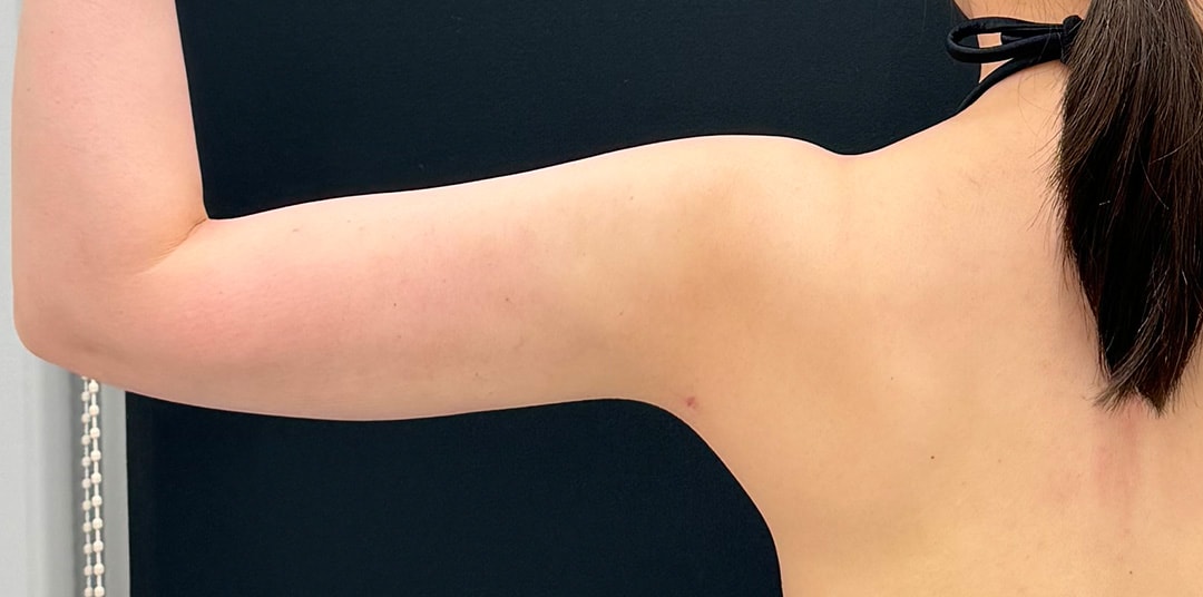 {施術名} {年代}  {性別} の術後の症例写真