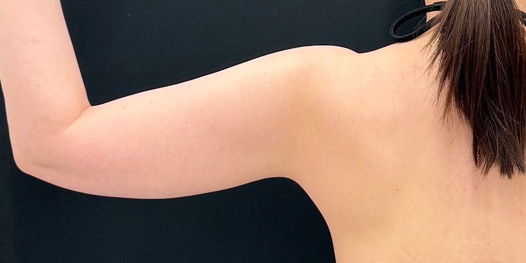 {施術名} {年代}  {性別} の術前の症例写真