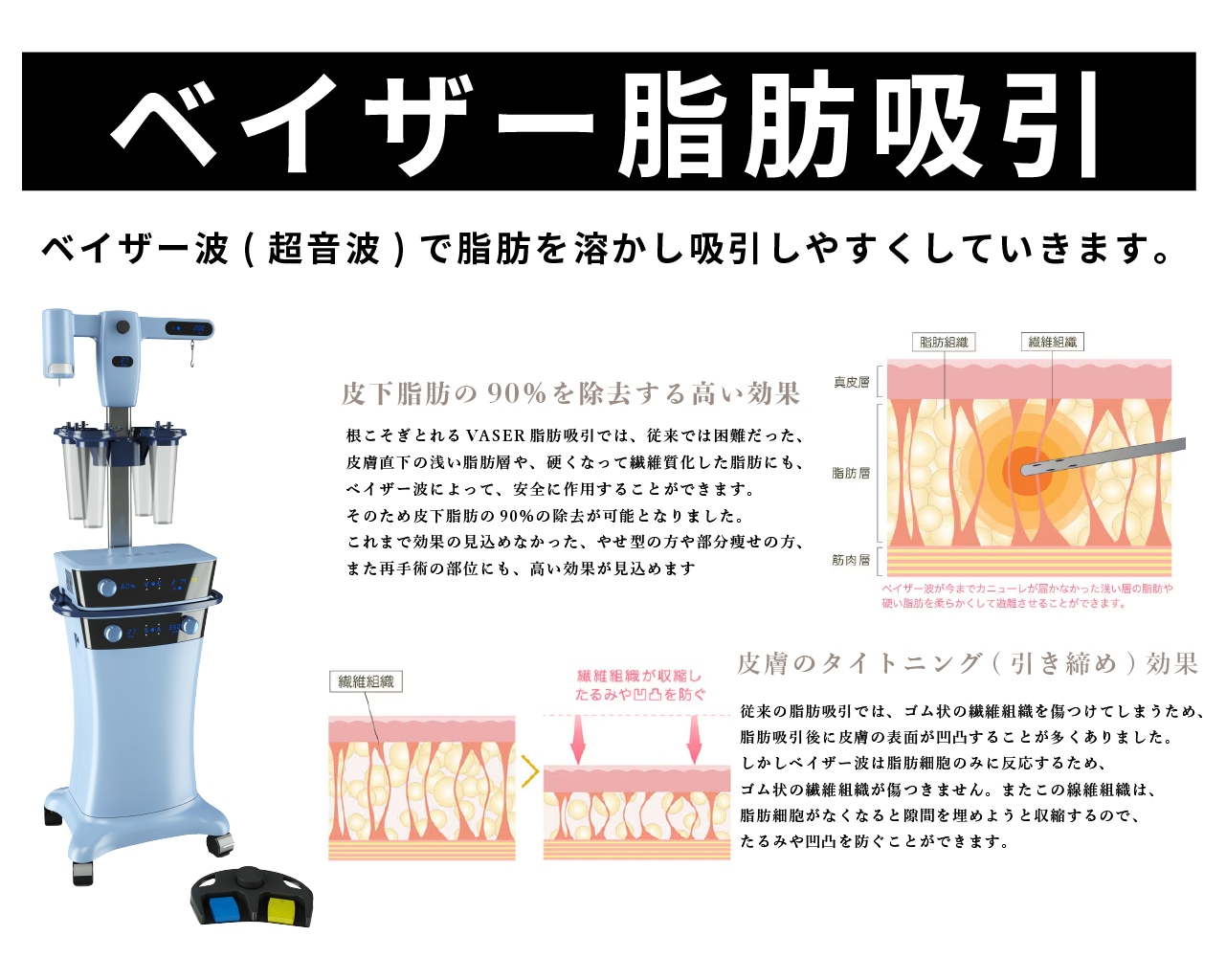 ベイザー脂肪吸引併用による強力な皮膚の引き締め